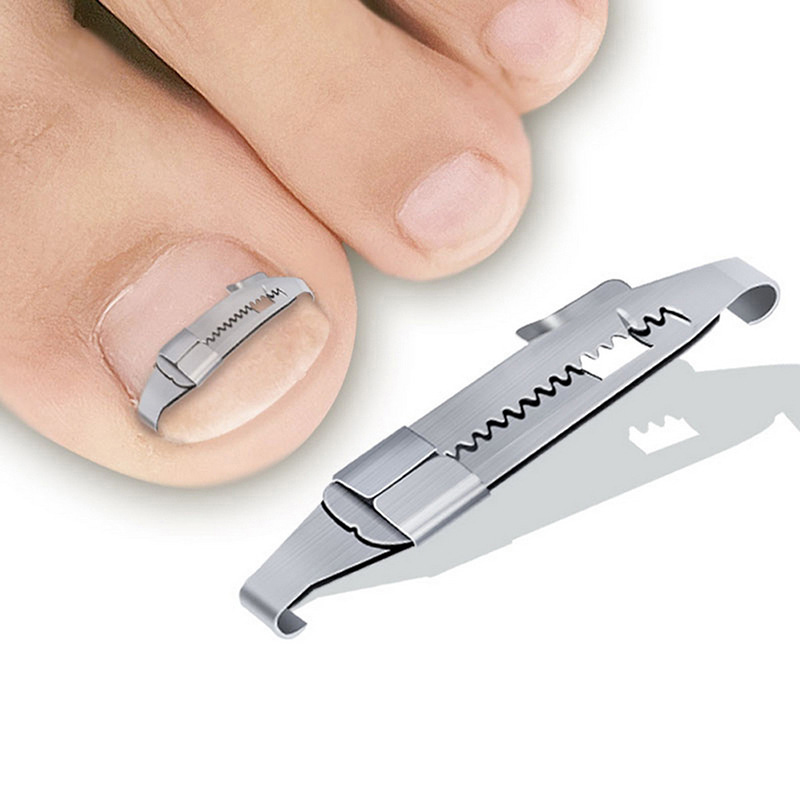 Power Tools Professional - Alat Korektor Kuku Kaki Tumbuh Ke